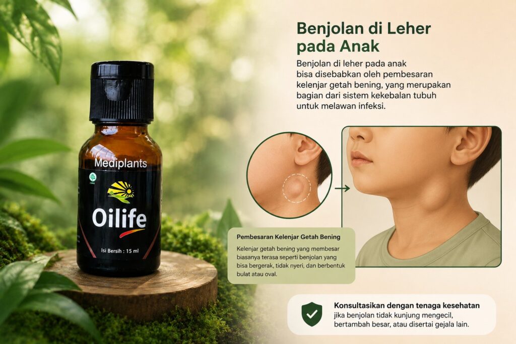 Ilustrasi obat herbal Oilife untuk benjolan di leher pada anak