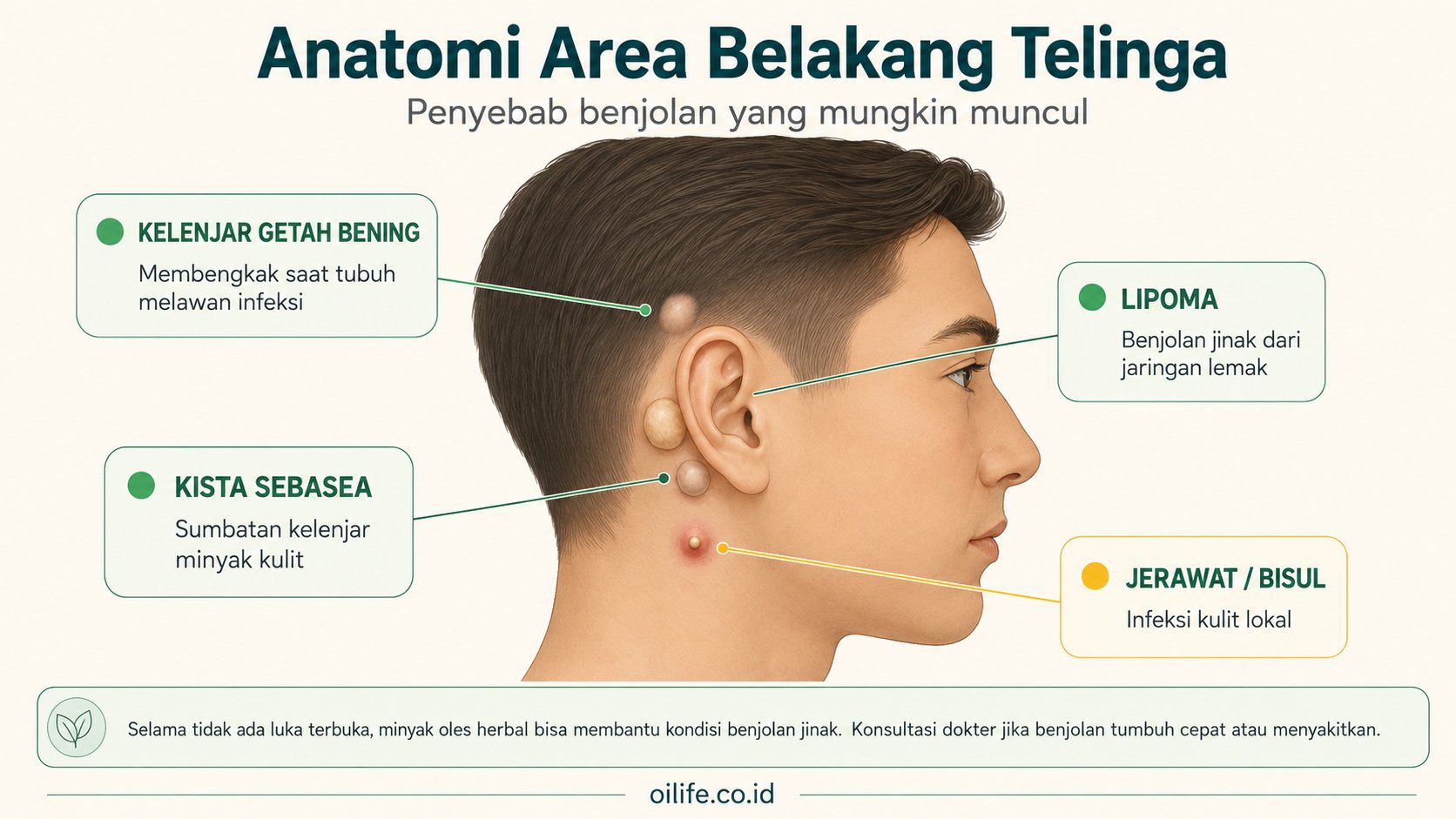 Anatomi area belakang telinga: lokasi benjolan kelenjar getah bening, lipoma, kista sebasea, dan jerawat